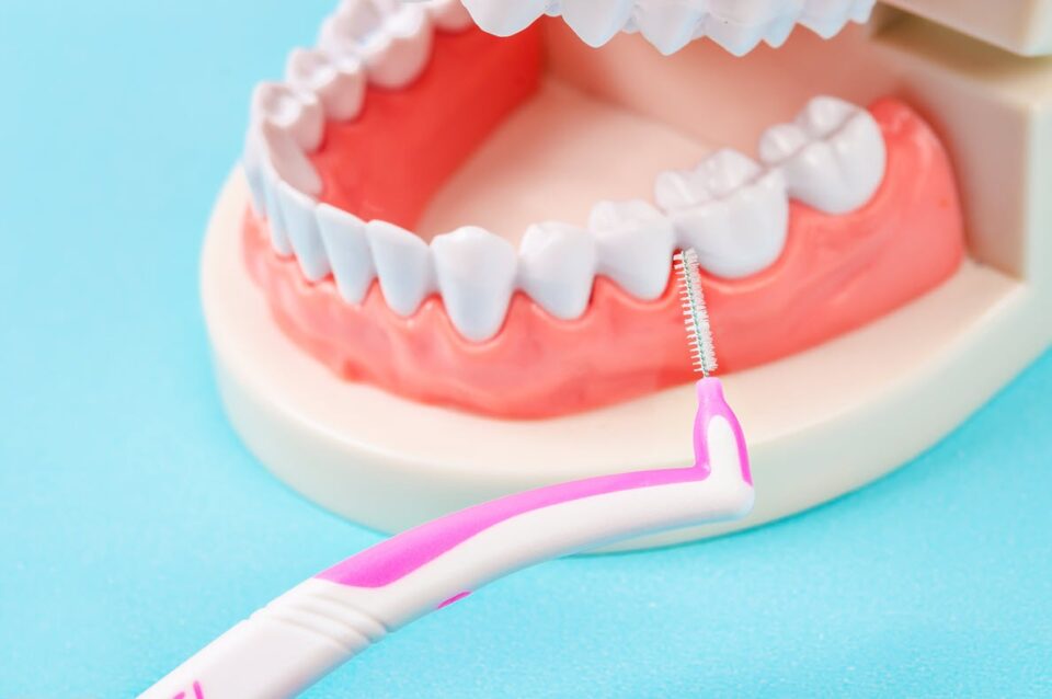 Cleaning Between Teeth: The Secret Behind A Truly Healthy Smile